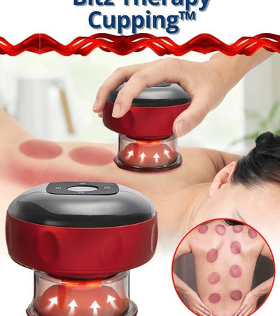 Electric Vacuum Massager - Bitz Therapy Cupping™ - BITZ